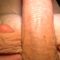 Fisted post